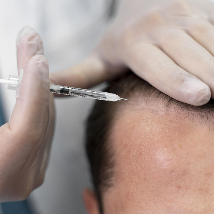 GFC Treatment